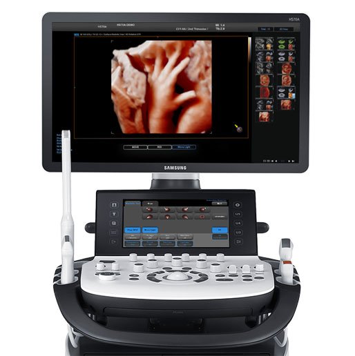 3D Sonography